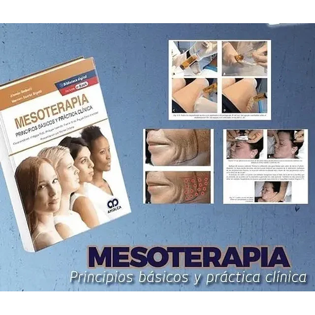 Mesoterapia. Principios básicos y práctica clínica