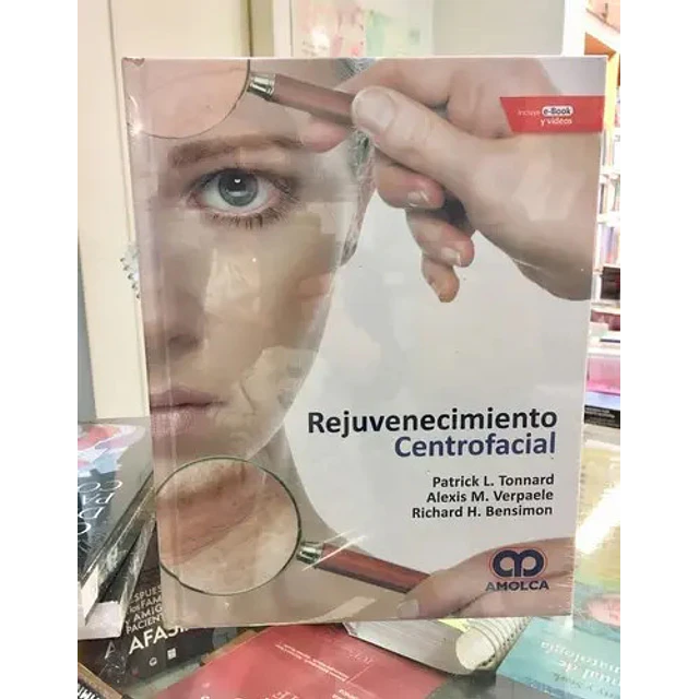 Rejuvenecimiento Centrofacial