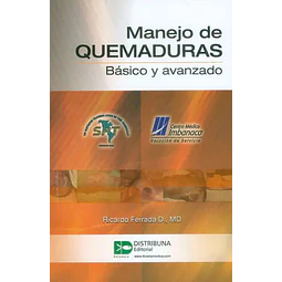 Manejo de Quemaduras