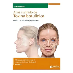 Atlas Ilustrado de Toxina Botulínica Vol 2