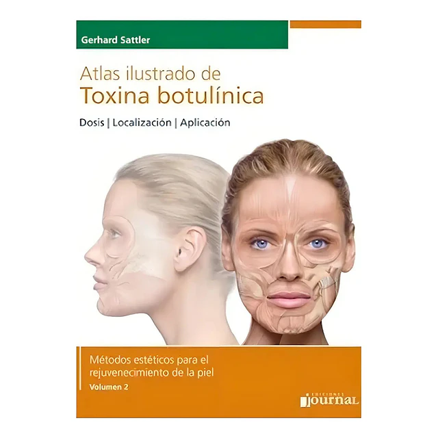 Atlas Ilustrado de Toxina Botulínica Vol 2