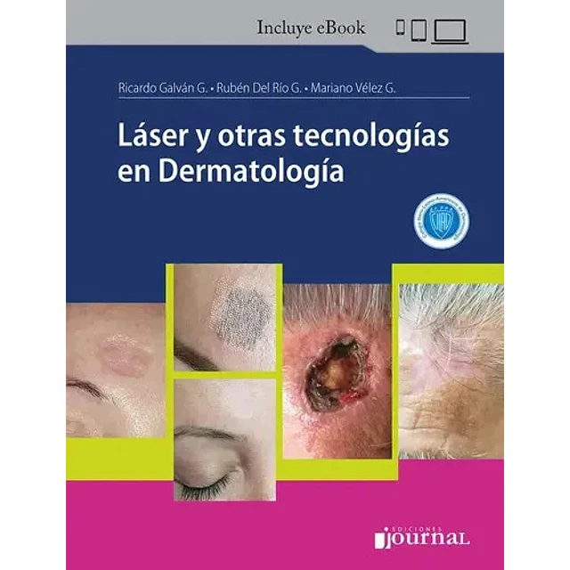 Láser y otras tecnologías en Dermatología