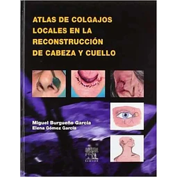Atlas de Colgajos Locales en la Reconstrucción de Cabeza y Cuello