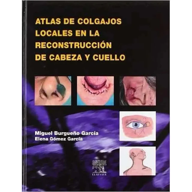 Atlas de Colgajos Locales en la Reconstrucción de Cabeza y Cuello