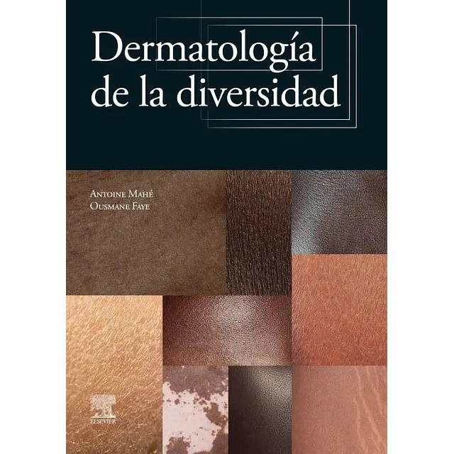 Dermatología de la diversidad