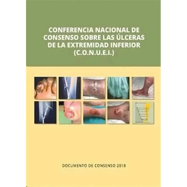 Conferencia nacional de consenso sobre las úlceras de la extremidad superior