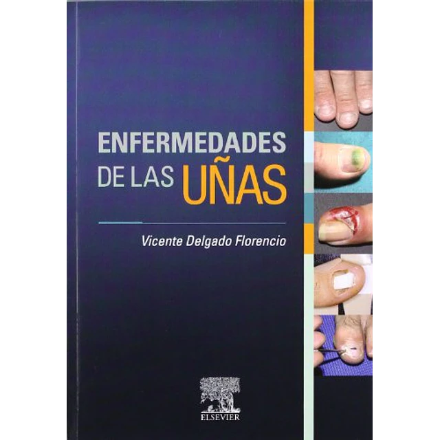 Enfermedades de la Uñas