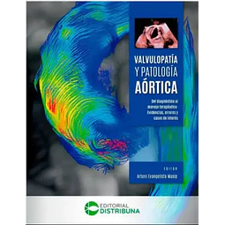 Valvulopatía y Patología AÓRTICA. Del diagnóstico al manejo terapéutico. Evidencias, errores y casos