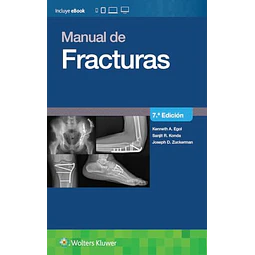 Manual de fracturas