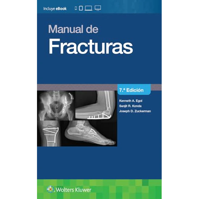 Manual de fracturas