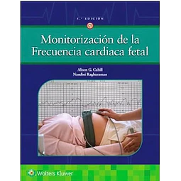 Monitorización de la frecuencia cardiaca fetal