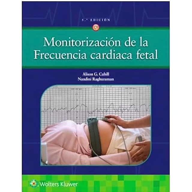 Monitorización de la frecuencia cardiaca fetal