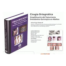 Cirugía Ortognática