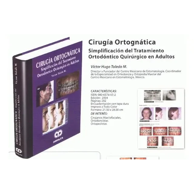 Cirugía Ortognática