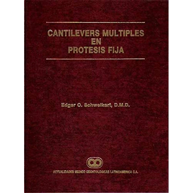 Cantilevers múltiples en prótesis fija