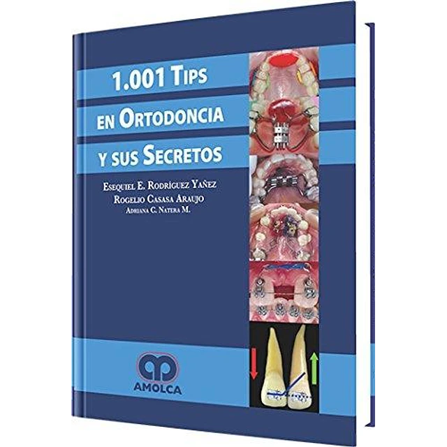 1001 Tips en Ortodoncia y sus Secretos