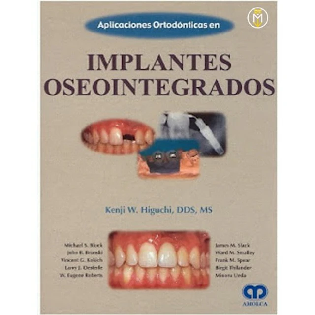Aplicaciones Ortodónticas en Implantes Oseosintegrados