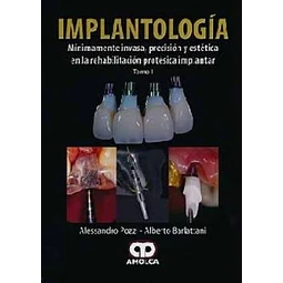 Implantología - 2 Tomos