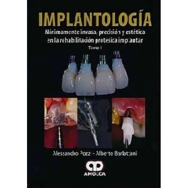 Implantología - 2 Tomos