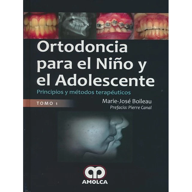 Ortodoncia para el niño y adolescente - 2 Tomos