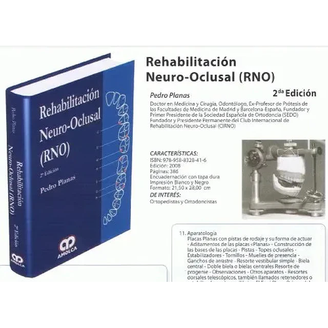 Rehabilitación Neuro-Oclusal RNO