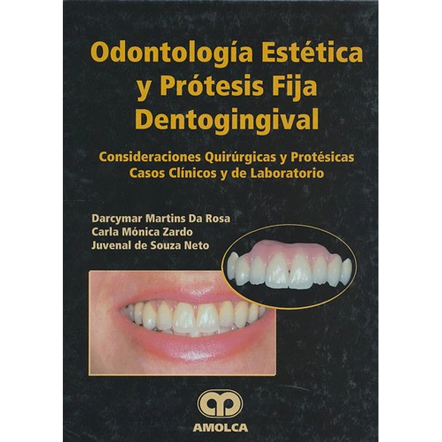 Odontología Estética y Prótesis Fija Dentogingival