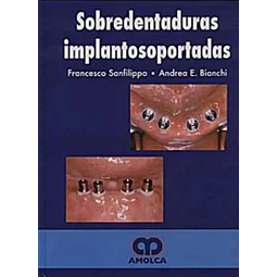 Sobredentaduras Implantosoportadas