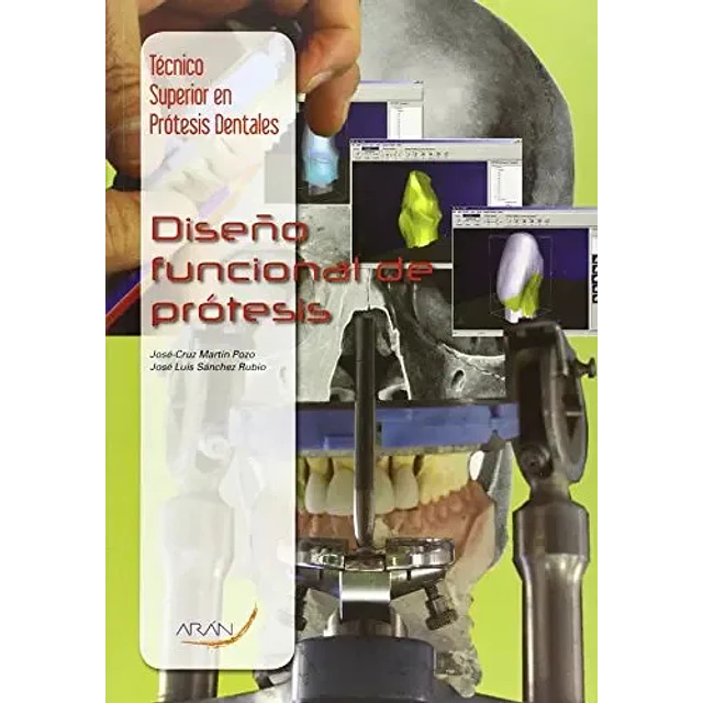 Diseño funcional de protesis
