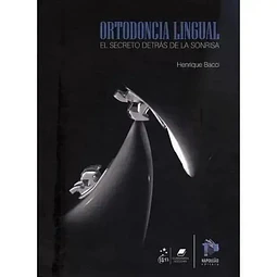 Ortodoncia Lingual