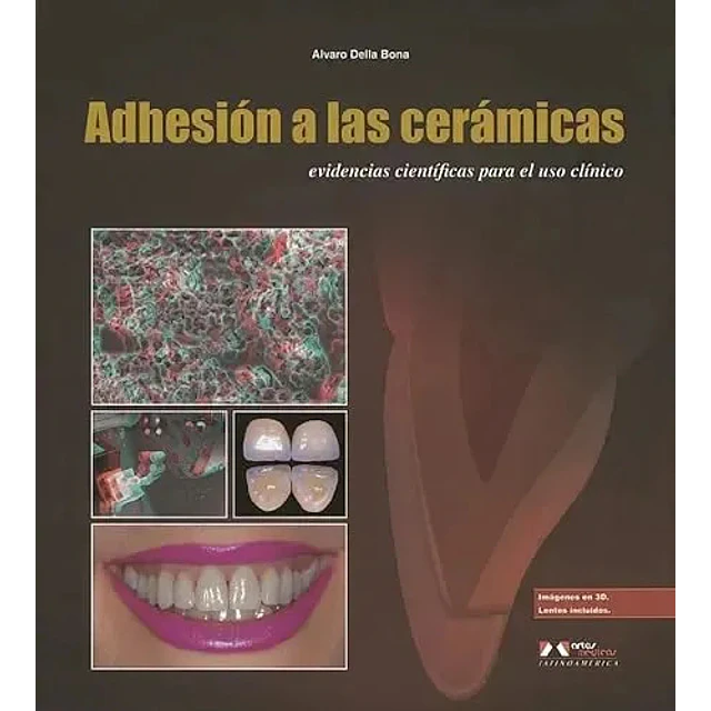 Adhesion a las ceramicas