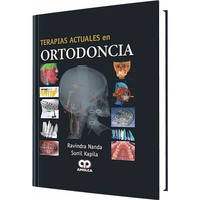 Terapias actuales en Ortodoncia
