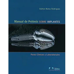 Manual de Protesis sobre Implantes