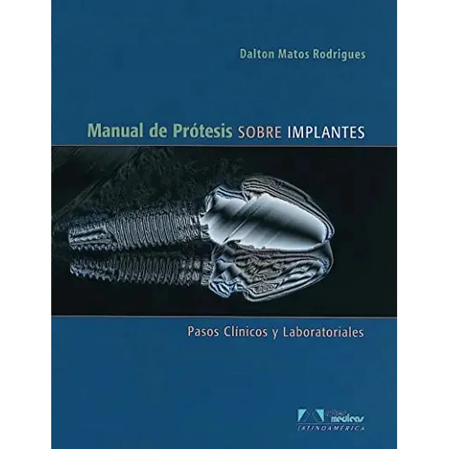 Manual de Protesis sobre Implantes