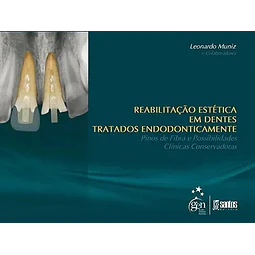 Rehabilitación Estética en Dientes Tratados Endodónticamente