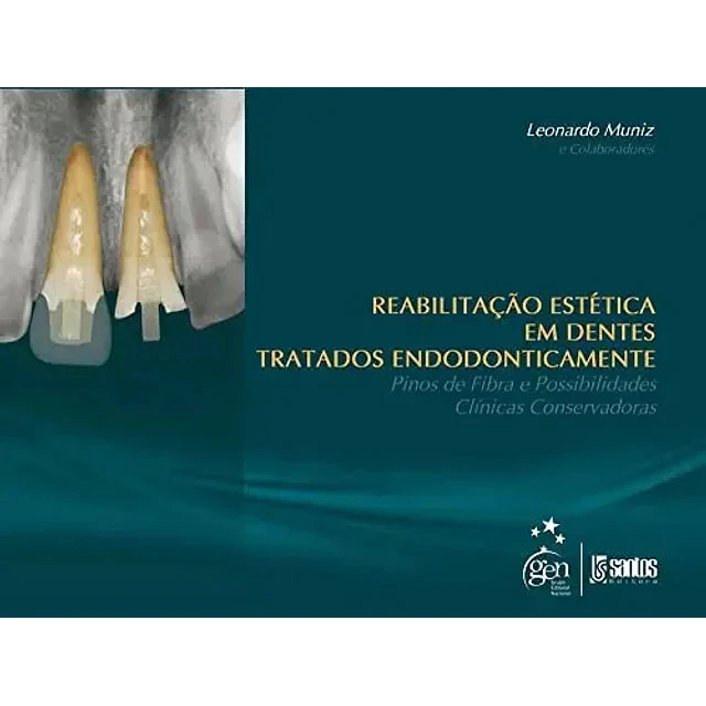 Rehabilitación Estética en Dientes Tratados Endodónticamente