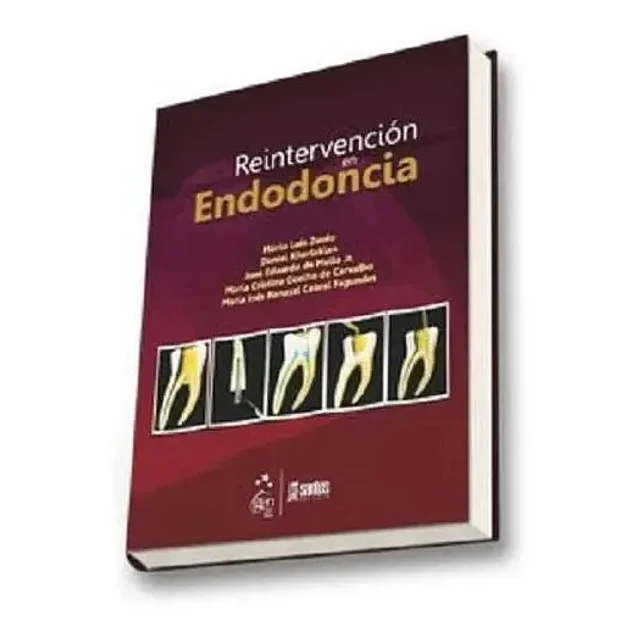 Reintervención en Endodoncia