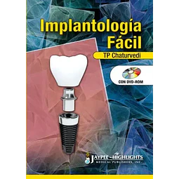 Implantología Fácil
