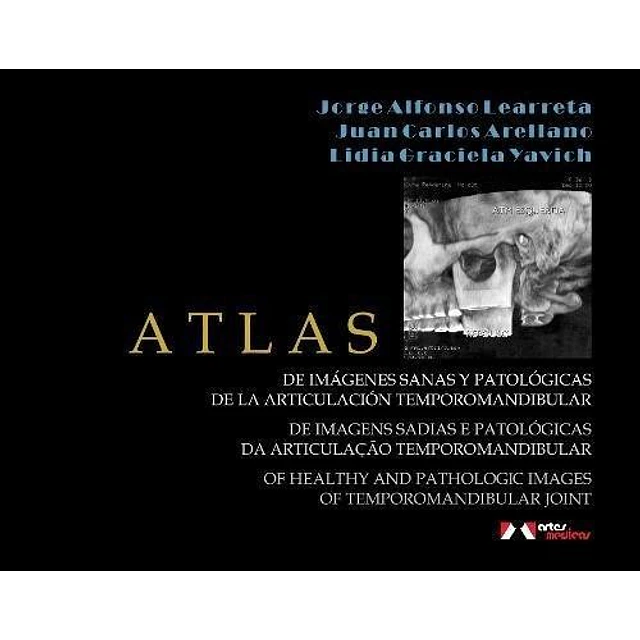 Atlas de imagenes sanas y patologicas de la articulacion temporomandibular