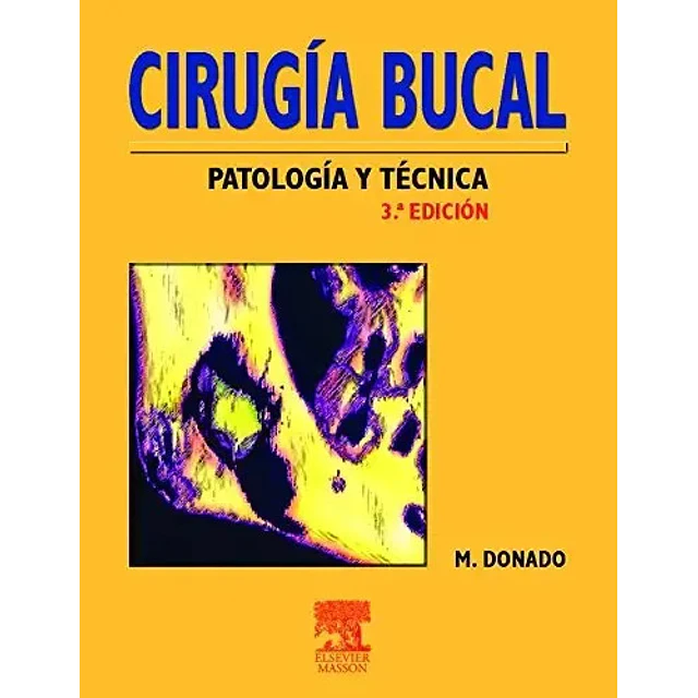 Cirugía Bucal