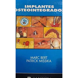 Implantes osteointegrados