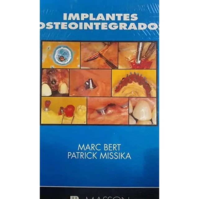 Implantes osteointegrados