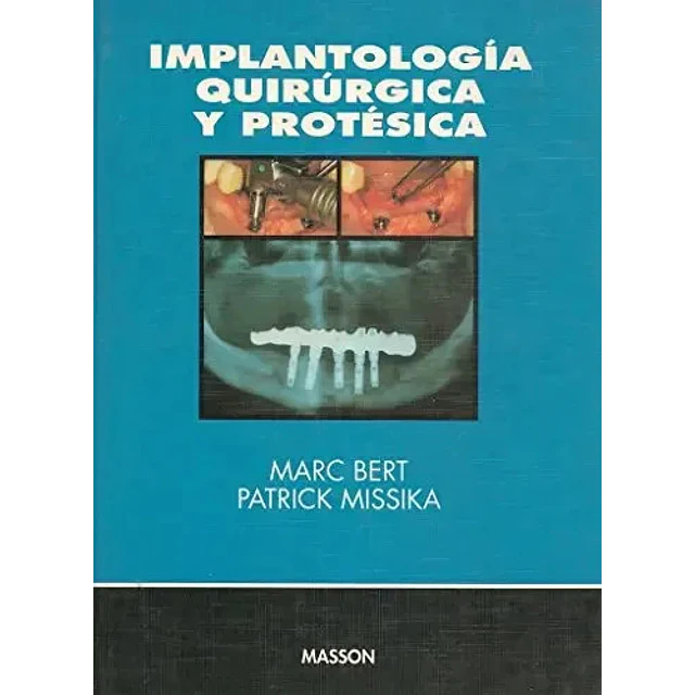 Implantologia quirurgica y protesica