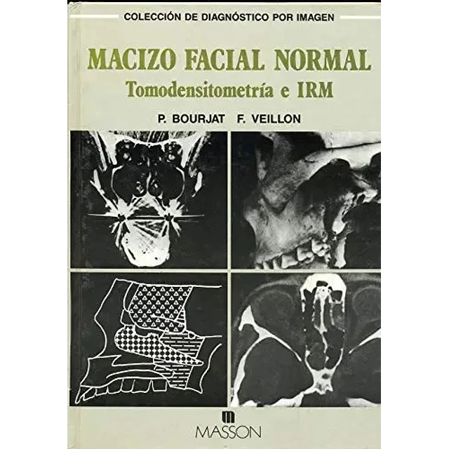 Macizo facial normal tomodensiometria e IRM