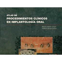 Atlas de procedimientos clinicos de implantologia oral