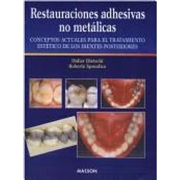 Restauraciones adhesivas no metalicas