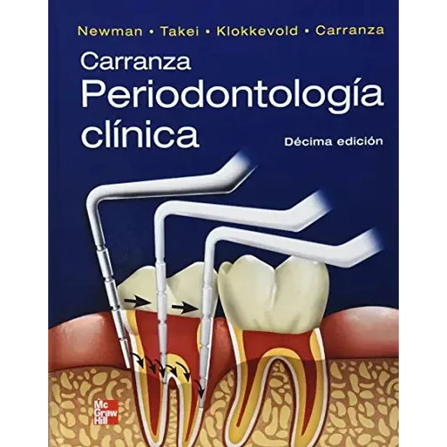 Periodontología Clínica Carranza