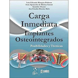 Carga Inmediata e Implantes Osteointegrados