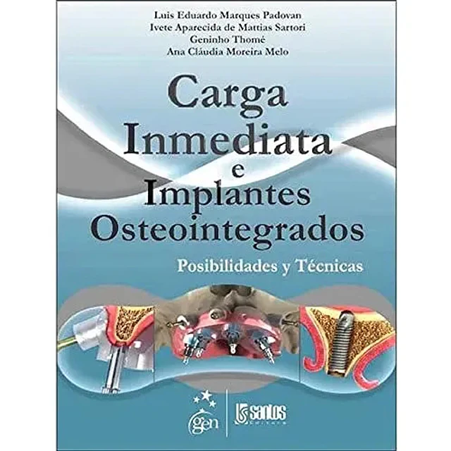 Carga Inmediata e Implantes Osteointegrados
