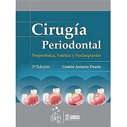 Cirugía Periodontal