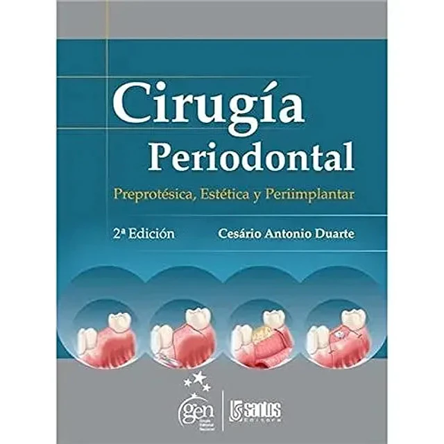 Cirugía Periodontal